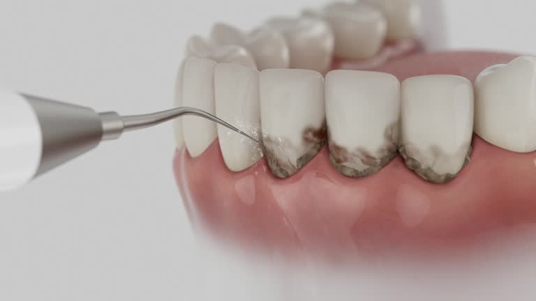 Trusted Dental Crowns And Bridges service in Ashland, IL - Dentist Open Now